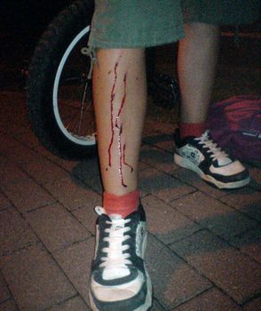 Einradbiss Einradbiss